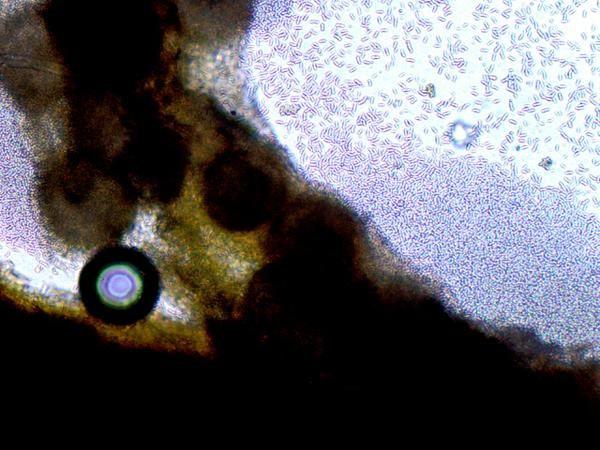 magnification of gummy stem blight pathogen